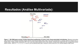 Resultados (Análise Multivariada):

Figure 1. 16S rRNA gene surveys reveals hierarchical partitioning of human tumor tissue-associated microbiomes. Bacterial communities
were clustered using Principal Coordinate Analysis (PCoA) of the full-tree-based Unifrac matrix. Each point corresponds to a sample colored to indicate tumor or
healthy status. Three principal components (PC1, PC2, and PC3) totally explained 43% of the variation. Sample name stated with their corresponding studied
patient number - S00X (X = 1, 2, 3, 4, 5, 6, 7, 8, and 9), and the following tissue type (C stands for cancer tissue and H for matched adjacent health tissue.

 