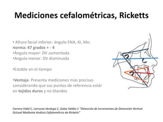 Seminario yo relaciones intermaxilares en desdentados totales | PPTX