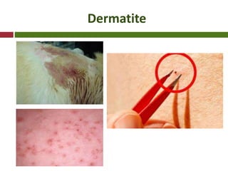Dermatite
 