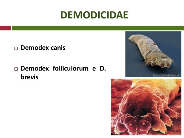 Demodex Folliculorum Rash 53522 | USBDATA