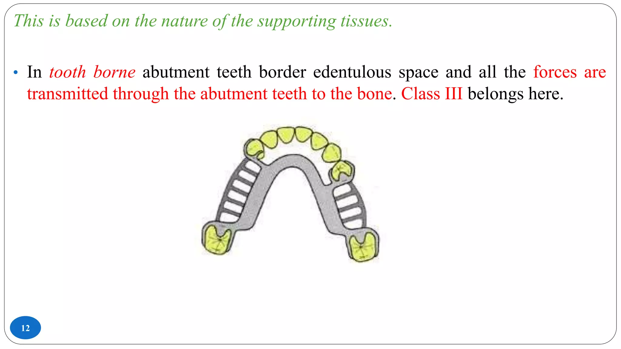 12
This is based on the nature of the supporting tissues.
• In tooth borne abutment teeth border edentulous space and all the forces are
transmitted through the abutment teeth to the bone. Class III belongs here.
 