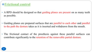 Management of Kennedys Class III Classification | PPTX
