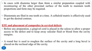 101
• In cases with diastema larger than 4mm a similar preparation coupled with
recontouring of the other proximal surface of the tooth to maintain tooth
proportions and form may be required.
• Diastemata are filed in one tooth at a time. A celluloid matrix is effectively used
to get the desired contour.
EFE and placement of composites in cervical defects
• Before any preparation, a gingival cord is placed in the sulcus to allow a proper
access to the defect and to keep away sulcular fluid or blood from the cavity
margins.
• A round bur is used to roughen the surface of the cavity and a long bevel is
placed on the occlusal edge of the cavity.
 