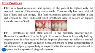 Fixed Prostheses
120
• FP-1 is a fixed restoration and appears to the patient to replace only the
anatomic crowns of the missing natural teeth. There usually has been minimal
loss of hard and soft tissues. The final restorations appears very similar in size
and contour to most traditional fixed prostheses used to restore or replace
natural crowns of teeth.
• FP –1 prosthesis is most often desired in the maxillary anterior region.
However the width and / or the height of the crestal bone is frequently lacking,
augmentation is often required before implant placement to achieve a natural
looking crown in the cervical region because there are no inter dental papillae in
edentulous ridges, gingivoplasty is required after the abutment is positioned to
improve the interproximal gingival contours.
 