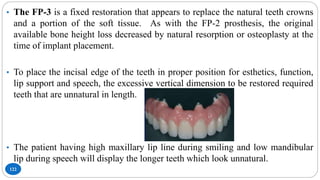 122
• The FP-3 is a fixed restoration that appears to replace the natural teeth crowns
and a portion of the soft tissue. As with the FP-2 prosthesis, the original
available bone height loss decreased by natural resorption or osteoplasty at the
time of implant placement.
• To place the incisal edge of the teeth in proper position for esthetics, function,
lip support and speech, the excessive vertical dimension to be restored required
teeth that are unnatural in length.
• The patient having high maxillary lip line during smiling and low mandibular
lip during speech will display the longer teeth which look unnatural.
 