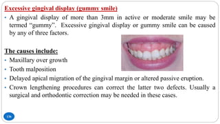 136
Excessive gingival display (gummy smile)
• A gingival display of more than 3mm in active or moderate smile may be
termed “gummy”. Excessive gingival display or gummy smile can be caused
by any of three factors.
The causes include:
• Maxillary over growth
• Tooth malposition
• Delayed apical migration of the gingival margin or altered passive eruption.
• Crown lengthening procedures can correct the latter two defects. Usually a
surgical and orthodontic correction may be needed in these cases.
 