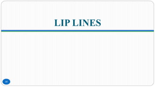 LIP LINES
15
 