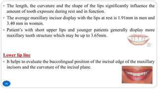 16
• The length, the curvature and the shape of the lips significantly influence the
amount of tooth exposure during rest and in function.
• The average maxillary incisor display with the lips at rest is 1.91mm in men and
3.40 mm in women.
• Patient’s with short upper lips and younger patients generally display more
maxillary tooth structure which may be up to 3.65mm.
Lower lip line
• It helps to evaluate the buccolingual position of the incisal edge of the maxillary
incisors and the curvature of the incisal plane.
 