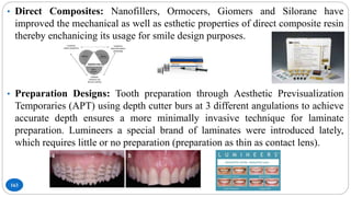 163
• Direct Composites: Nanofillers, Ormocers, Giomers and Silorane have
improved the mechanical as well as esthetic properties of direct composite resin
thereby enchanicing its usage for smile design purposes.
• Preparation Designs: Tooth preparation through Aesthetic Previsualization
Temporaries (APT) using depth cutter burs at 3 different angulations to achieve
accurate depth ensures a more minimally invasive technique for laminate
preparation. Lumineers a special brand of laminates were introduced lately,
which requires little or no preparation (preparation as thin as contact lens).
 