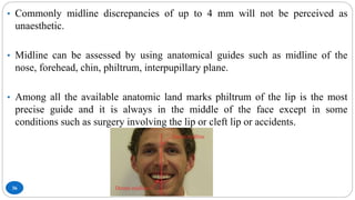 36
• Commonly midline discrepancies of up to 4 mm will not be perceived as
unaesthetic.
• Midline can be assessed by using anatomical guides such as midline of the
nose, forehead, chin, philtrum, interpupillary plane.
• Among all the available anatomic land marks philtrum of the lip is the most
precise guide and it is always in the middle of the face except in some
conditions such as surgery involving the lip or cleft lip or accidents.
 
