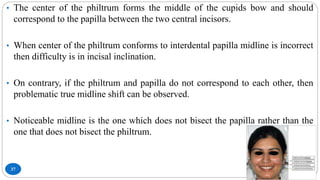 37
• The center of the philtrum forms the middle of the cupids bow and should
correspond to the papilla between the two central incisors.
• When center of the philtrum conforms to interdental papilla midline is incorrect
then difficulty is in incisal inclination.
• On contrary, if the philtrum and papilla do not correspond to each other, then
problematic true midline shift can be observed.
• Noticeable midline is the one which does not bisect the papilla rather than the
one that does not bisect the philtrum.
 