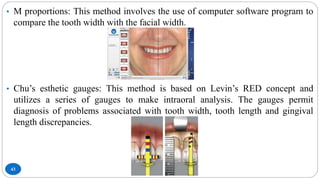 43
• M proportions: This method involves the use of computer software program to
compare the tooth width with the facial width.
• Chu’s esthetic gauges: This method is based on Levin’s RED concept and
utilizes a series of gauges to make intraoral analysis. The gauges permit
diagnosis of problems associated with tooth width, tooth length and gingival
length discrepancies.
 