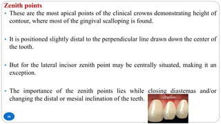 Zenith points
46
• These are the most apical points of the clinical crowns demonstrating height of
contour, where most of the gingival scalloping is found.
• It is positioned slightly distal to the perpendicular line drawn down the center of
the tooth.
• But for the lateral incisor zenith point may be centrally situated, making it an
exception.
• The importance of the zenith points lies while closing diastemas and/or
changing the distal or mesial inclination of the teeth.
 