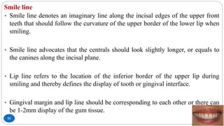 Smile line
53
• Smile line denotes an imaginary line along the incisal edges of the upper front
teeth that should follow the curvature of the upper border of the lower lip when
smiling.
• Smile line advocates that the centrals should look slightly longer, or equals to
the canines along the incisal plane.
• Lip line refers to the location of the inferior border of the upper lip during
smiling and thereby defines the display of tooth or gingival interface.
• Gingival margin and lip line should be corresponding to each other or there can
be 1-2mm display of the gum tissue.
 