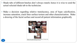 69
• Shade tabs of different batches don’t always match; hence it is wise to send the
actual selected shade tab to the technician.
• Make a decision regarding relative translucency, area of hypo calcification,
increase saturation, crack lines surface texture and other characterization. Make
a drawing of the facial surface and record all patient information graphically
 