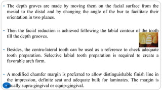 91
• The depth groves are made by moving them on the facial surface from the
mesial to the distal and by changing the angle of the bur to facilitate their
orientation in two planes.
• Then the facial reduction is achieved following the labial contour of the tooth
till the depth grooves.
• Besides, the contra-lateral tooth can be used as a reference to check adequate
tooth preparation. Selective labial tooth preparation is required to create a
favorable arch form.
• A modified chamfer margin is preferred to allow distinguishable finish line in
the impression, definite seat and adequate bulk for laminates. The margin is
usually supra-gingival or equip-gingival.
 