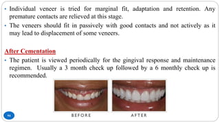 94
• Individual veneer is tried for marginal fit, adaptation and retention. Any
premature contacts are relieved at this stage.
• The veneers should fit in passively with good contacts and not actively as it
may lead to displacement of some veneers.
After Cementation
• The patient is viewed periodically for the gingival response and maintenance
regimen. Usually a 3 month check up followed by a 6 monthly check up is
recommended.
 