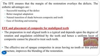 98
The EFE ensures that the margin of the restoration overlays the defects. The
esthetic advantages are :
• Successful masking of the defect
• Better marginal adaptation
• Natural transition of shade between composite and tooth
• Ease of finishing and texturing
EFE and placement of composite for malaligned teeth
• The preparation in mal aligned teeth is a typical and depends upon the degree of
rotation and angulation exhibited by the teeth and hence a uniform layer of
composite cannot be placed to treat such teeth.
• The effective use of opaque composites in areas having no tooth or thin palatal
structure, improves the blending of the restoration.
 