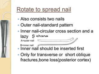 Cortexed Nail Seminar k nail | PPTX | Death, Injury, or Military Conflict | Sensitive ...