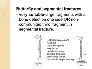 Fragment Defect Seminar k nail | PPTX