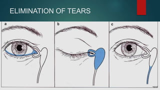 ELIMINATION OF TEARS
 
