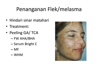 Penanganan Flek/melasma
• Hindari sinar matahari
• Treatment:
• Peeling GA/ TCA
– FW AHA/BHA
– Serum Bright C
– MF
– WHM
 
