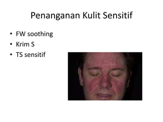 Penanganan Kulit Sensitif
• FW soothing
• Krim S
• TS sensitif
 