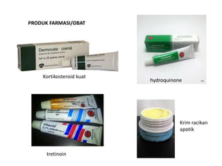Kortikosteroid kuat
PRODUK FARMASI/OBAT
hydroquinone
tretinoin
Krim racikan
apotik
 