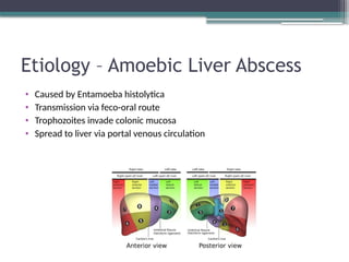 seminar liver abscess complication management | PPTX