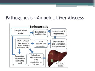 seminar liver abscess complication management | PPTX