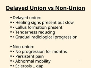 SEMINAR MALUNION NON UNION and It's .pptx