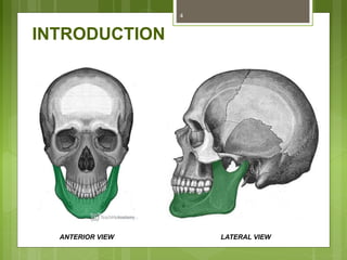 INTRODUCTION
4
ANTERIOR VIEW LATERAL VIEW
 