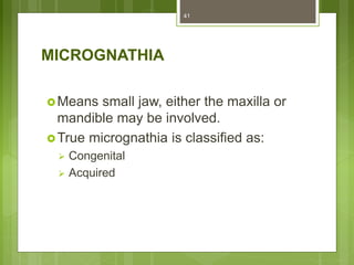 MICROGNATHIA
Means small jaw, either the maxilla or
mandible may be involved.
True micrognathia is classified as:
 Congenital
 Acquired
41
 