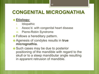 CONGENITAL MICROGNATHIA
 Etiology:
I. Idiopathic
II. Assoc’d. with congenital heart disease
III. Pierre-Robin Syndrome
 Follows a hereditary pattern.
 Agenesis of condyles results in true
micrognathia.
 Such cases may be due to posterior
positioning of the mandible with regard to the
skull or to a steep mandibular angle resulting
in apparent retrusion of mandible.
42
 