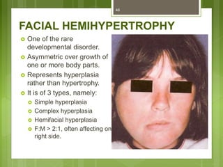 FACIAL HEMIHYPERTROPHY
 One of the rare
developmental disorder.
 Asymmetric over growth of
one or more body parts.
 Represents hyperplasia
rather than hypertrophy.
 It is of 3 types, namely:
 Simple hyperplasia
 Complex hyperplasia
 Hemifacial hyperplasia
 F:M > 2:1, often affecting on
right side.
46
 