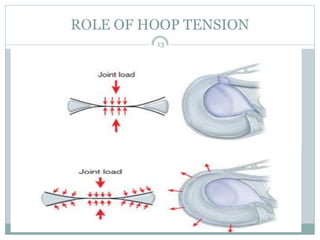 ROLE OF HOOP TENSION
13
 