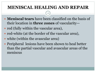 MENISCAL HEALING AND REPAIR
 Meniscal tears have been classified on the basis of
their location in three zones of vascularity—
 red (fully within the vascular area),
 red-white (at the border of the vascular area),
 white (within the avascular area)
 Peripheral lesions have been shown to heal better
than the partial vascular and avascular areas of the
meniscus
16
 