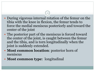  During vigorous internal rotation of the femur on the
tibia with the knee in flexion, the femur tends to
force the medial meniscus posteriorly and toward the
center of the joint
 The posterior part of the meniscus is forced toward
the center of the joint, is caught between the femur
and the tibia, and is torn longitudinally when the
joint is suddenly extended.
 Most common location: posterior horn of
meniscus
 Most common type: longitudinal
20
 