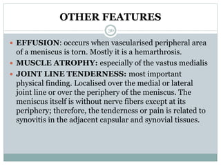 OTHER FEATURES
 EFFUSION: occcurs when vascularised peripheral area
of a meniscus is torn. Mostly it is a hemarthrosis.
 MUSCLE ATROPHY: especially of the vastus medialis
 JOINT LINE TENDERNESS: most important
physical finding. Localised over the medial or lateral
joint line or over the periphery of the meniscus. The
meniscus itself is without nerve fibers except at its
periphery; therefore, the tenderness or pain is related to
synovitis in the adjacent capsular and synovial tissues.
30
 
