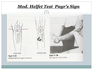 Mod. Helfet Test Payr’s Sign
37
 