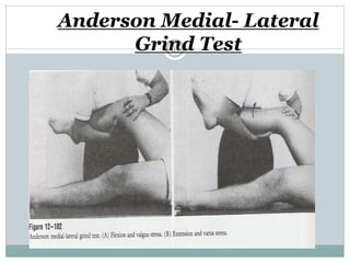 Anderson Medial- Lateral
Grind Test39
 