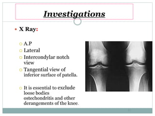 Investigations
 X Ray:
 A.P
 Lateral
 Intercondylar notch
view
 Tangential view of
inferior surface of patella.
 It is essential to exclude
loose bodies
ostechondritis and other
derangements of the knee.
41
 