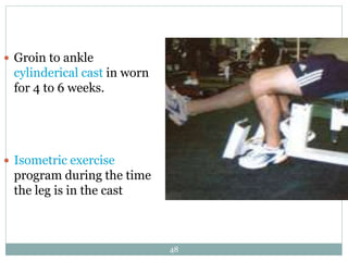  Groin to ankle
cylinderical cast in worn
for 4 to 6 weeks.
 Isometric exercise
program during the time
the leg is in the cast
48
 