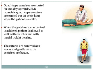  Quadriceps exercises are started
on 2nd day onwards, SLR
isometric quadriceps exercises
are carried out on every hour
when the patient is awake.
 When the good muscular control
is achieved patient is allowed to
walk with crutches and with
partial weight bearing.
 The sutures are removed at 2
weeks and gentle resistive
exercises are begun.
58
 