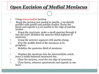 Open Excision of Medial Meniscus
 Using anteromedial incision
 Begin the incision just medial to patella, 5 cm distally
parallel with patella and patellar tendon. Incise the
fascia and capsule 0.5 cm medial to the edge of patellar
tendon .
 Grasp the synovium, make a small opening through it
into the joint. Mobilize the anterior third segment of
meniscus.
 Grasp the anterior segment with martin clamp.
 Free the middle third of the meniscus at its
periphery.
 Mobilize the posterior third of meniscus.
 Displace the meniscus into the intercondylar notch,
leave a stable balanced menisceal rim.
 Close the incision, evert the cut edge of synovium.
 Close fascia, extensor aponeurosis and capsule in one
layer.
59
 