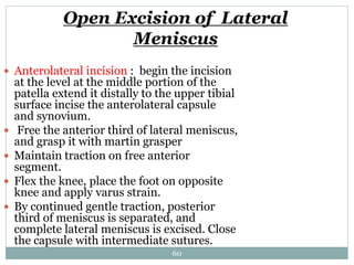 Open Excision of Lateral
Meniscus
 Anterolateral incision : begin the incision
at the level at the middle portion of the
patella extend it distally to the upper tibial
surface incise the anterolateral capsule
and synovium.
 Free the anterior third of lateral meniscus,
and grasp it with martin grasper
 Maintain traction on free anterior
segment.
 Flex the knee, place the foot on opposite
knee and apply varus strain.
 By continued gentle traction, posterior
third of meniscus is separated, and
complete lateral meniscus is excised. Close
the capsule with intermediate sutures.
60
 