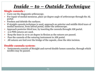 Inside – to – Outside Technique
Single cannula :
 Carry out the diagnostic arthroscopy.
 For repair of medial meniscus, place 30 degree angle of arthroscope through the AL
portal.
 Freshen and debride the surfaces.
 If straight cannula technique is used, approach an anterior and middle third tears of
medial meniscus, from lateral portal, under the arthroscope.
 Approach posterior third tear, by inserting the cannula throught AM portal.
 2-0 PDS sutures are used.
 Keep the knee in 10 to 20 degree in flexion as the sutures are passed.
 Pass the cannula of the suturing instrument in AM portal.
 All sutures are tied over the bridge of the capsule, close the skin incision.
Double cannula system:
 Instruments consists of Straight and curved double lumen cannulas, through which
needles may be passed.
70
 