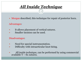 All Inside Technique
 Morgan described, this technique for repair of posterior horn.
Advantages:
 It allows placement of vertical sutures.
 Smaller incision can be used.
Disadvantages:
 Need for special instrumentation.
 Difficulty with intraarticular knot tieing.
 All inside technique, can be performed by using commercial
available T – fix sutures.
72
 