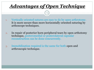 Advantages of Open Technique
1. Vertically oriented sutures are easy to do by open arthrotomy.
It is more secure than more horizontally oriented suturing by
arthoscope techniques.
2. In repair of posterior horn peripheral tears by open arthotomy
technique, posteromedial or posterolateral capsular
reconstruction can be done concurrently.
3. Immobilization required is the same for both open and
arthroscopic technique.
73
 
