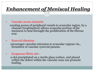 Enhancement of Meniscal Healing
 Vascular access channels:
creating access of peripheral vessels to avascular region, by a
channel (trephination) allows avascular portion of the
meniscus to heal throught the proliferation of the fibrous
scar.
 Synovial abrasion :
encourages vascular extension to avascular regions via.,
formation of vascular synovial pannus.
 Exogenous fibrin clot :
a clot precipitated on a sterile glass surface, and placed
within the defect within the vascular zone can promote
healing.
84
 